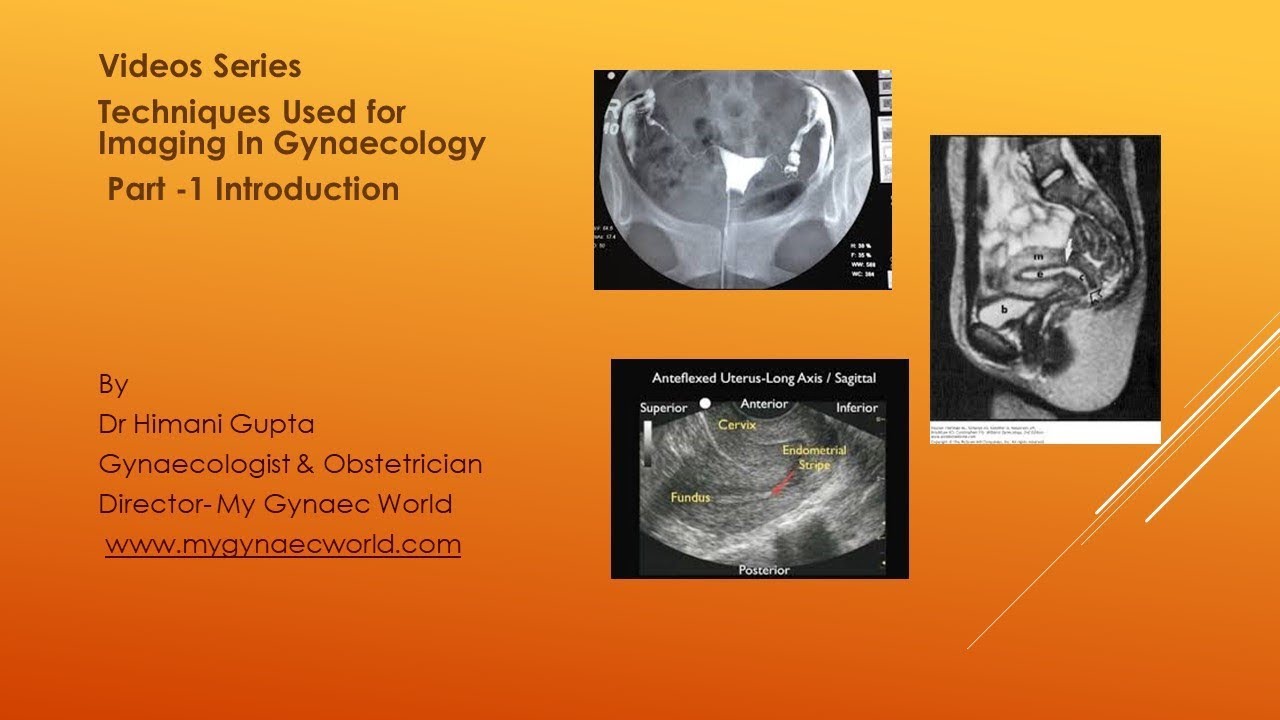 Videos Series Techniques Used for Imaging In Gynaecology, Part 1
