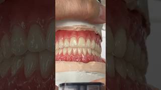 Great Bite #dental #teeth #smile #lsk121shorts #shortvideo #shorts