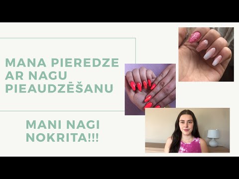 Video: Trauslie Nagi: Cēloņi, Profilakse Un ārstēšana