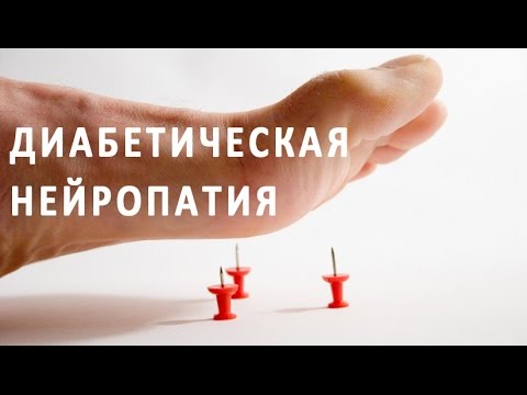 Диабетическая нейропатия. Профилактика и лечение нейропатии при диабете