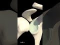 What Exactly Is a Dislocated Shoulder (Animation)