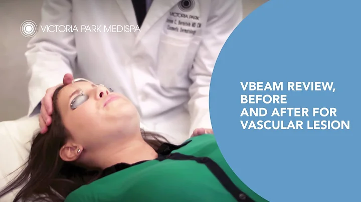 Vbeam Review. Before and After for Vascular Lesion -- Victoria Park