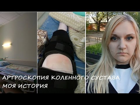 Артроскопия/ Меня узнали в операционной))/ Реабилитация