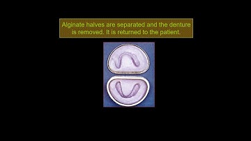 Removable 501 | Lec 6 | Denture duplication