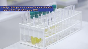 Abstract-Dosage of Catecholamines in urine and in plasma - Part II