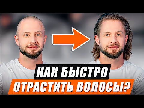 Лучшие Средства Для Роста Волос! Как Отрастить Длинные Волосы Мужчине