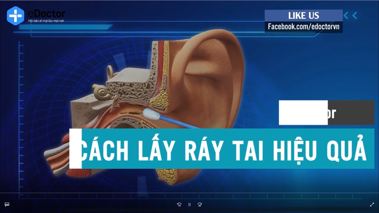🎥 CÁCH LẤY RÁY TAI HIỆU QUẢ - YouTube