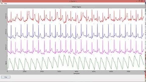WxPython based Real time Vital Sign monitor GUI Demo