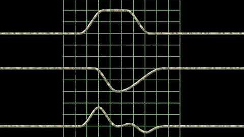 Superposition of two pulses on a rope