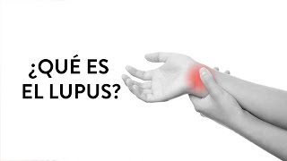 ¿Qué es el Lupus? | Martha Debayle