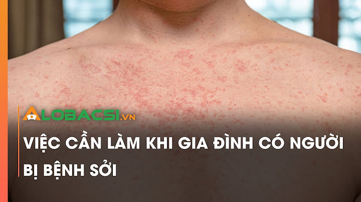 Khi nào tiêm phòng sởi quai bị rubella cho trẻ năm 2024