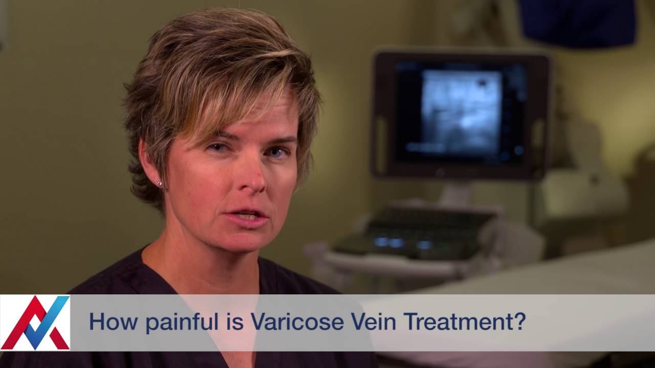 How painful is varicose vein treatment?