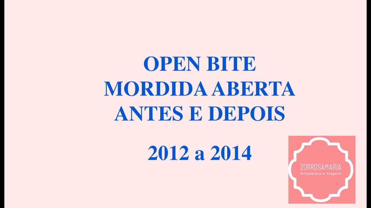 aparelho antes e depois aparelho antes e depois