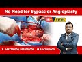 New Technology for heart treatment - No Need for Bypass or Angioplasty | Dr. Bimal Chhajer | Saaol