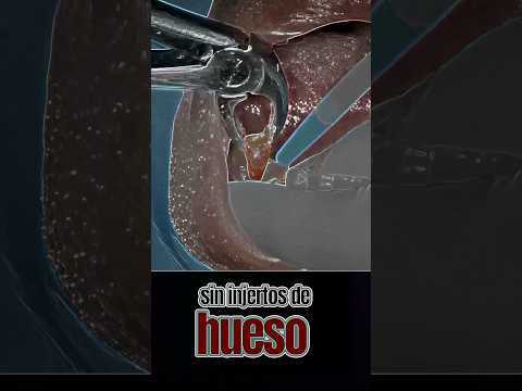 Así de simple