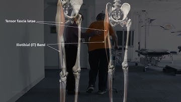 Restoring Functional Gait