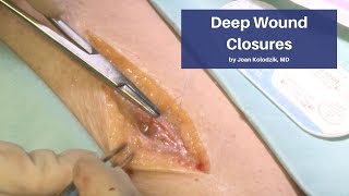 Deep Wound Closures | The Cadaver-Based Suturing Course screenshot 5