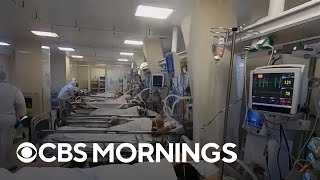Experts believe Russia's COVID death toll is almost four times higher than government reports