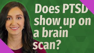Does PTSD show up on a brain scan?
