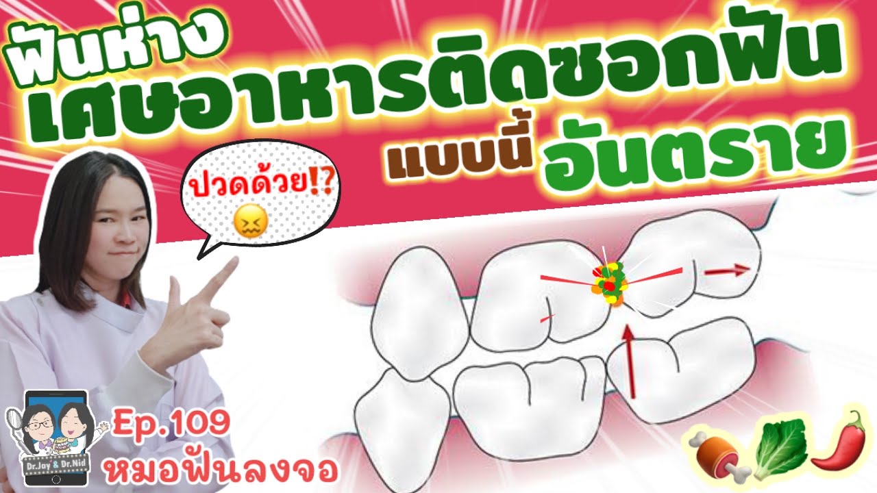 ฟันห่าง เศษอาหารติดซอกฟัน แบบนี้อันตราย!! @หมอฟันลงจอ Ep.109