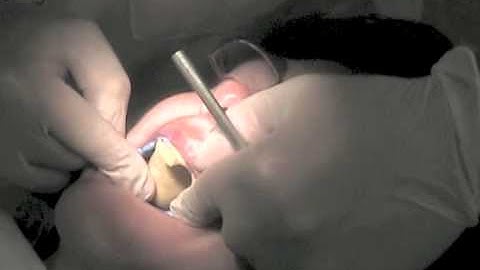 22 Final CD Impressions (Outdated, see link to new HD video below)