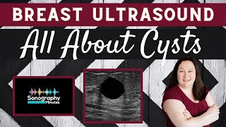 Breast Ultrasound | All About Breast Cysts | #Sonographyminutes