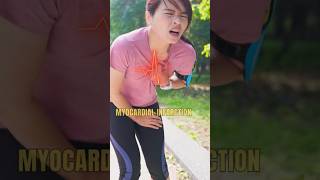 Heart Attack, Cardiac Arrest & Heart Failure — Easy Explanation in Hindi #shorts #heartattack