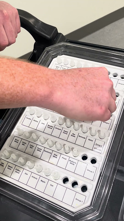 Allergy scratch test explained | Ohio State Medical Center