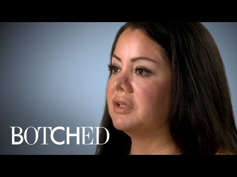 Mariela Went in for Liposuction But Got a New Nose Instead | Botched | E!