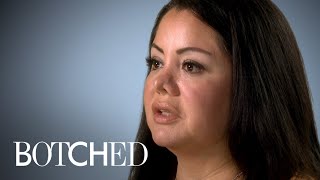 Mariela Went in for Liposuction But Got a New Nose Instead | Botched | E!