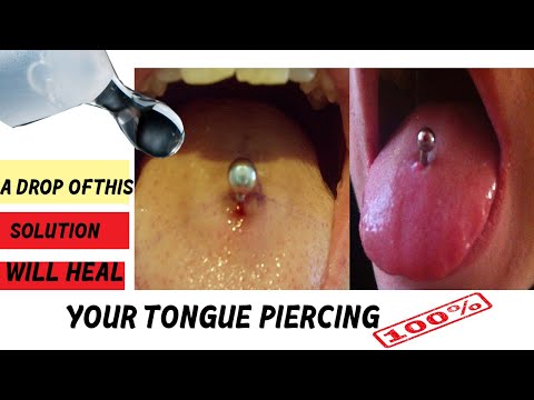 Tongue Piercing Infection: Symptoms, Treatment, Prevention |  /At Home Remedy. infected piercings