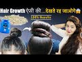 14 Days Hair Growth Transformation : Regrow Lost Hair, Get Double Density &amp; Thick Long Hair❤️