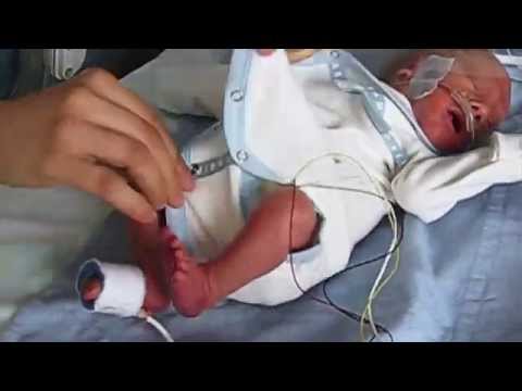 Video: Liittäminen preemie-vauvaasi: selviytyminen vastasyntyneestä vastasyntyneiden tehohoitoryhmässä NICU