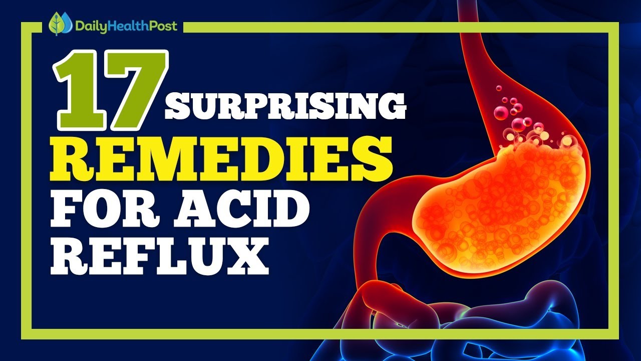 17 Home Remedies For Acid Reflux - YouTube