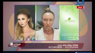 برنامج سيداتي انساتي | حل مشاكل البشرة بدون عمليات تجميل مع 