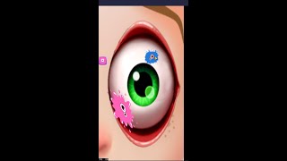Eye Doctor  Game Part 2  Android Gameplay #gaming #shorts #trending screenshot 2