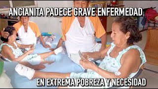 Ancianita padece grave enfermedad en extrema pobreza. La ayuda es una luz de esperanza