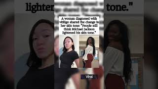 Her Skin Changed Overnight 😢✨ — Now She’s Speaking Out to Set the Record Straight 💔🕊️#shorts