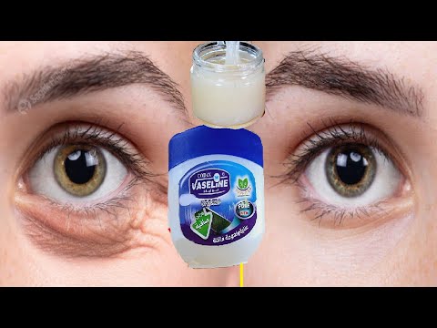 In 3 Days Remove Puffiness And Wrinkles Under The Eyes Even If You Re 90 Years Old