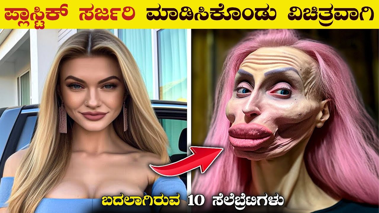 Top 10 Celebrities Before & After Plastic Surgery | 10 Unusual Plastic Surgeries | VismayaVani