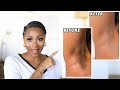 HOW I GOT RID OF MY DARK UNDERARMS | HOW TO BRIGHTEN YOUR ARMPITS + KEEP THEM EVEN & SMOOTH!!