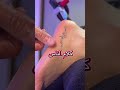 حكي العالم حمل عليك، منك مضطر تحملو و تتحمّلو #تخت_الإعتراف #زين_العابدين #massage #hijama #relax