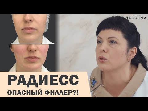 РАДИЕСС ⛔ ОПАСНЫЙ ФИЛЛЕР⁉️ОСЛОЖНЕНИЯ РАДИЕСС 🔥