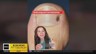 Local dermatologist takes to TikTok to explain certain cancer risks