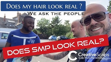 Does SMP Look Real ? | Creative Scalps Scalp MicroPigmentation