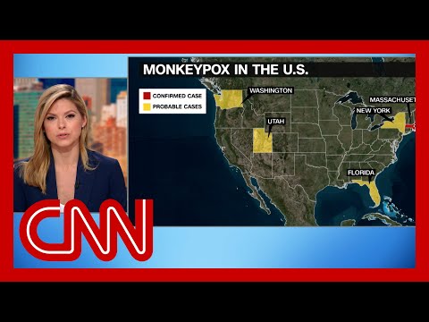 CDC issues new monkeypox warning as more potential cases found – CNN