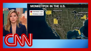CDC issues new monkeypox warning as more potential cases found