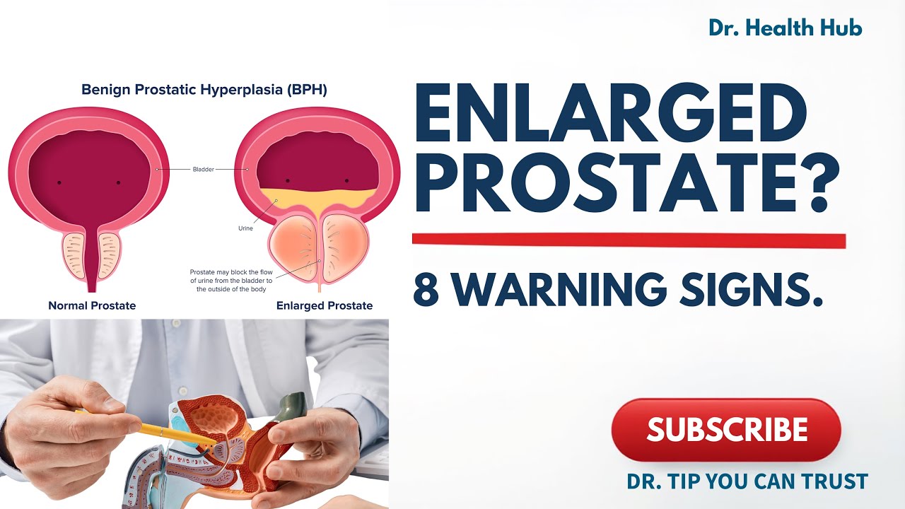 Prostate Warning Add Enlarged Prostate (BPH): 8 Warning Signs Men Should Never Ignore ...