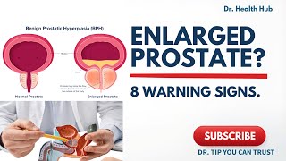 Enlarged Prostate (BPH): 8 Warning Signs Men Should Never Ignore | Doctor Explains