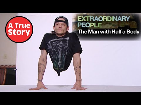 The Man With Half A Body The FULL Documentary Nine Lives Media